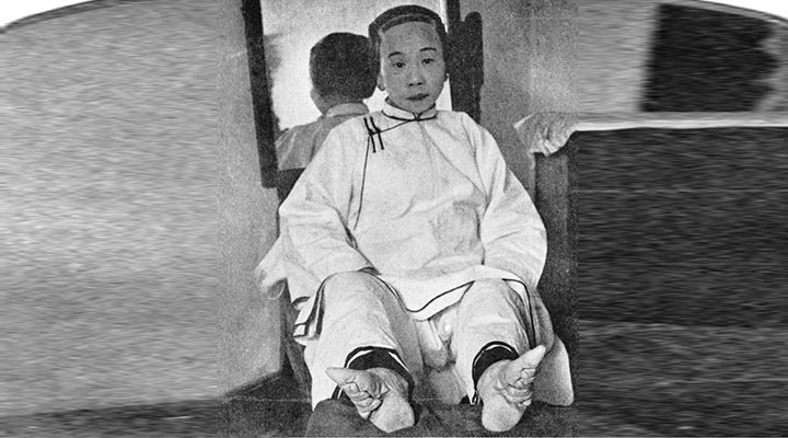 «Лотосовые ножки»: изящная и невыносимо болезненная китайская традиция